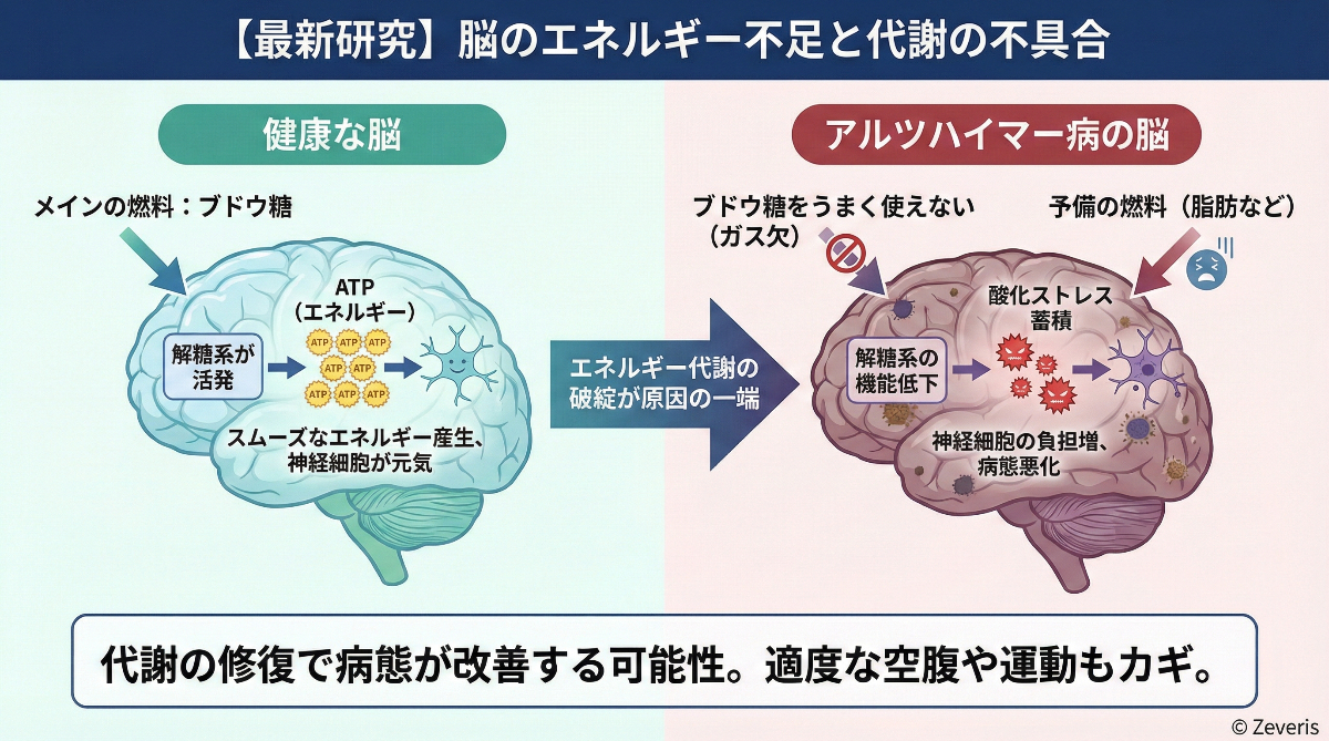 【最新研究】アルツハイマー病は「脳のエネルギー不足」が原因の一端か？代謝の修復で病態が改善する可能性
